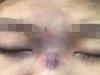 Làm đẹp nhanh gọn, giá rẻ: Giấc mơ tàn chỉ sau một đêm