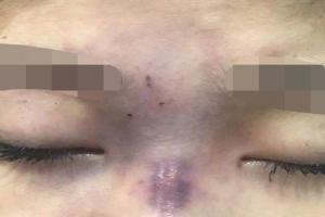 Làm đẹp nhanh gọn, giá rẻ: Giấc mơ tàn chỉ sau một đêm